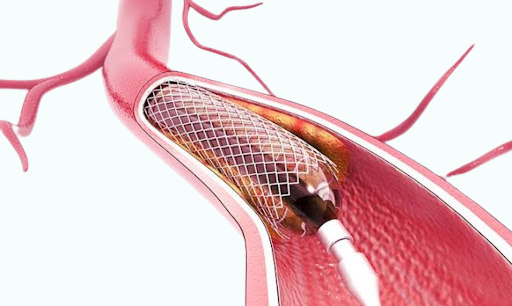 Diagnostic Equipment